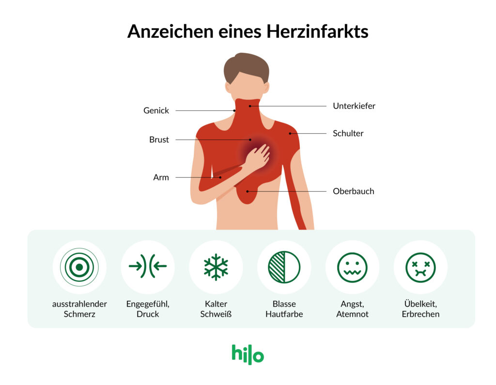 Grafischer Überblick über die Anzeichen eines Herzinfarkts